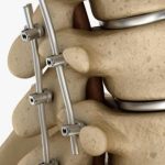 De beste Kiropraktor i Nore og Uvdal